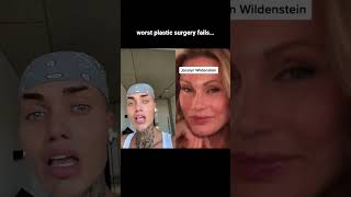 Worst Plastic Surgery Fails