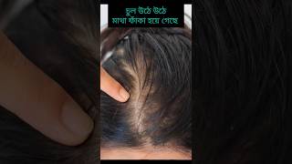 চুল পড়া বন্ধ হয়ে নতুন চুল গজাবে/chul pora bondho korar upay/Hair regrowth/Hair fall control oil