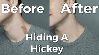 How to Cover a Hickey with Men's Concealer