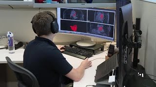 LogOn: Artificial Intelligence Screening for Heart Disease, Cancers | VOANews