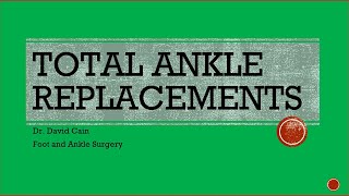 Total Ankle Replacements 8/17/22