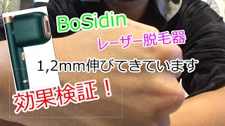 【Bosidin ボシディン レーザー脱毛器】[3]効果検証動画1～家庭用脱毛器の効果気になりません?～毛深い人必見!