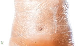 ALERT | The Dangers of Wrapping Your Stomach With Plastic Wrap