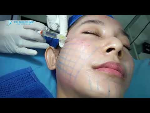 DNA SALMON BOOSTER TREATMENT WAJAH GLOWING & KENCANG | FIFI SKIN CLINIC ...