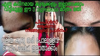 How To Remove Pimples Naturally | Malayalam | Olive Vibes