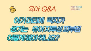 육아 Q\u0026A ; 아기 머리에 딱지가 생기는 유아 지루성 피부염 어떻게 해야 하나요?