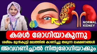 ശരീരം മുൻകൂട്ടി മലത്തിൽ കാണിച്ചുതരുന്ന ലക്ഷണങ്ങൾ അവഗണിച്ചാൽ നിത്യരോഗിയാക്കും|karal rogha nirnayam