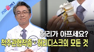 [건강 콜센터] 허리가 아프세요? … 척추관협착증·허리디스크의 모든 것