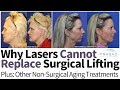 Why Lasers Cannot Replace Surgical Lifting, Plus Treating Facial Volume Loss Non-Surgically