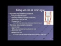 Thyroïde : les risques de la chirurgie.