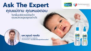 Ask the Expert คุณแม่ถาม คุณหมอตอบ เรื่อง  “โรคผื่นแพ้ผิวหนังในเด็ก คุณแม่ควรดูแลลูกอย่างไร”