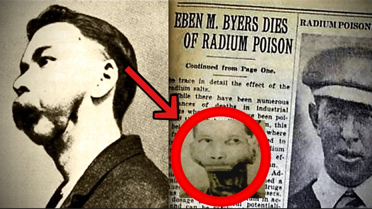 Horrific History Of A Man Whose Jaw Fell Off| Eben Byers - YouTube