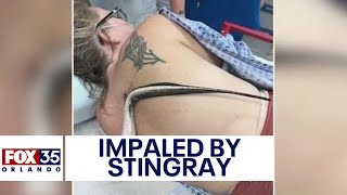 Venomous stingray IMPALES Florida woman swimming at the beach