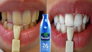 மஞ்சள் பற்கள் வெள்ளையாக இதை செய்தாலே போதும் | how to get from yellow teeth to white teeth tips