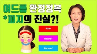 (*Eng)여드름 피지의 진실은? 여드름 부위별 원인 \u0026 완전정복How to Get Rid of Acne Forever [정라레]