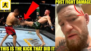 Team Conor McGregor believes this is how Conor broke his leg in fight versus Dustin Poirier, Perry