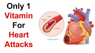 Unbelievable ! Only 1 Vitamin To Prevent Heart Attack