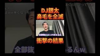 鼻毛を全部抜いた結果www【レペゼン切り抜き】【DJふぉい】