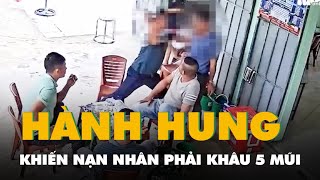 Một cán bộ xã bị tố hành hung người mời bia khiến nạn nhân phải khâu 5 mũi