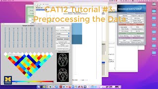 CAT12 Tutorial #3: Preprocessing
