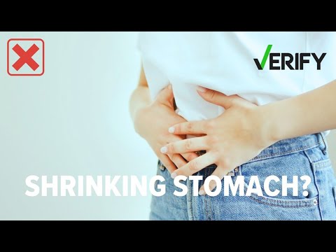 Can you shrink your stomach?