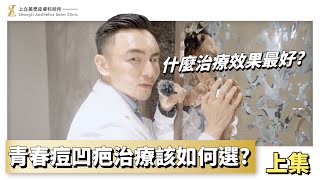 #青春痘凹疤 治療如何選？什麼治療效果最好？🤔