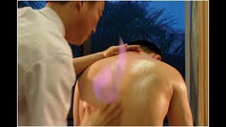 睢阳中医风湿病医院火酒疗法 Fire liquor therapy for rheumatoid arthritis,Fire Massage or fire treatment