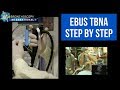 EBUS Bronchoscopy - Endobronchial Ultrasound Step by Step