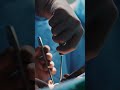 Advanced Robotic Surgery | Robotic Surgery | Minimally Invasive Surgery|Operation Theatre 2|#shorts