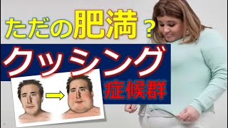 【クッシング症候群】肥満の原因はホルモンが原因だった！