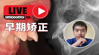 为孩子操碎了心的妈妈们，儿童早期矫正合集