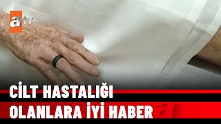 KÜBA ÖZEL DOSYASI – Plasentadan cilt hastalığına şifa