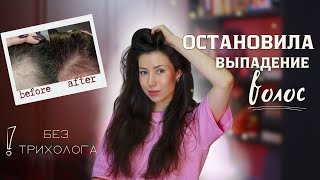 Я почти потеряла волосы, но остановила выпадение благодаря этим средствам