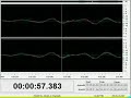 wow signal recieved at seti on aug 15 1977