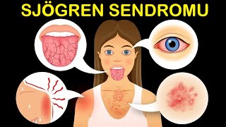 Sjögren Sendromu: En Etkili Protokol Nedir? | Dr.Berg Türkçe