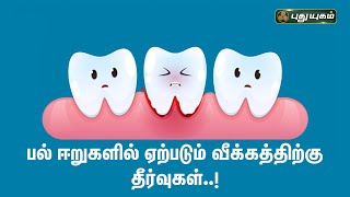 பல் ஈறுகளில் ஏற்படும் வீக்கத்திற்கு தீர்வுகள்..! | Tips for Swollen Gums | Dr.M.S.UshaNandhini