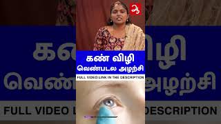 கண் விழி வெண்படல அழற்சி  | Conjunctivitis symptoms Homeopathy treatment #shorts