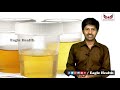 color of urine indicates health మీ మూత్రం రంగును బట్టి మీ ఆరోగ్యం గురించి తెలుసుకోవొచ్చు