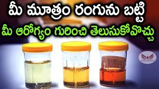 color of urine indicates Health | మీ మూత్రం రంగును బట్టి మీ ఆరోగ్యం గురించి తెలుసుకోవొచ్చు