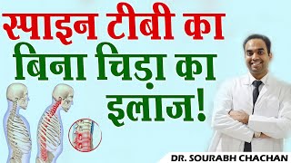 स्पाइन टीबी का बिना कट लगाए इलाज ! // Spine TB Treatment Without Open Surgery