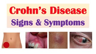 Crohn’s Disease Signs and Symptoms (& Why They Occur), and Complications & Deficiencies