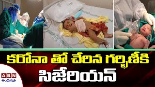 కరోనా తో చేరిన గర్భిణీకి సిజేరియన్ | Visakhapatnam Latest News | ABN Telugu