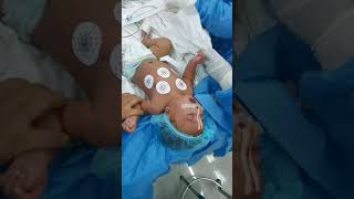 Baby crying diffrently waking up after surgery