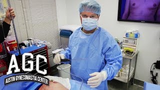 New Gynecomastia Treatment Using Vaser Ultrasonic Liposuction - Austin Gynecomastia Center