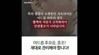 여름에 더 무서운 여드름!