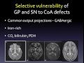 How defects in pantothenate metabolism cause neurodegeneration