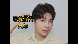 想戴假发却又觉得丢人，过不去心里那道坎？来听听过来人的经验