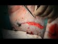 Splenectomy in a dog