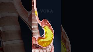 What happens in your body when you VOMIT? 🤢 Explained in 3D