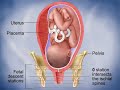 fetal_descent birth effacement childbirth stations of presentation